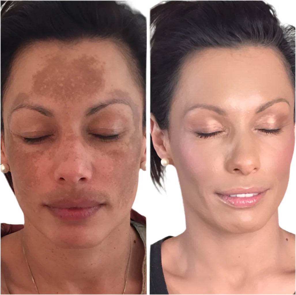 Axis-Y Dark spot correcting serum